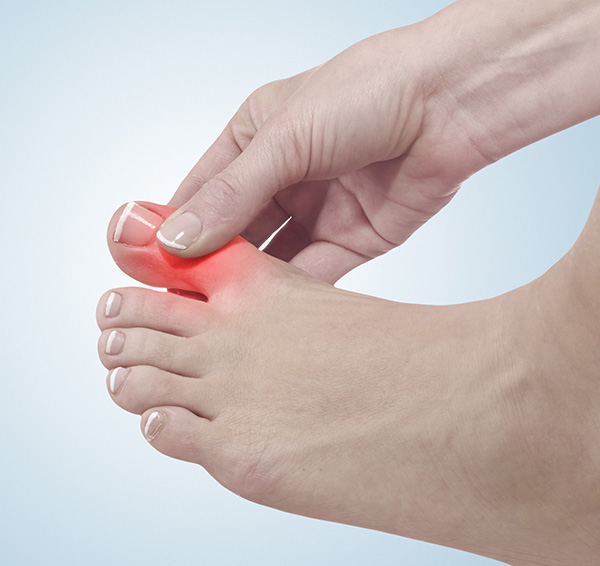 The Foot and Ankle Center of Issaquah | Athlete s Foot, Fungal Nails and Foot Surgery